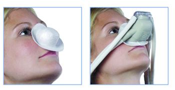 WhiteGAPS Barrier Device for