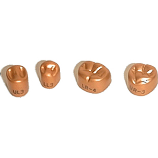 Gold Anodized Molar Crowns