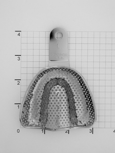 Stainless Steel Edentulous