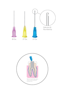 OptiProbe Needle Tips 30ga