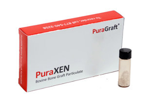 PuraCAL Calcium Sulfate Kit