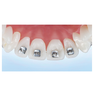 Tongue Tamers Curved Base