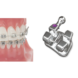 Votion Metal Brackets 022 LR3