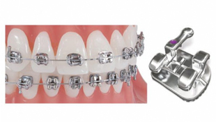 Pinnacle Stainless Steel