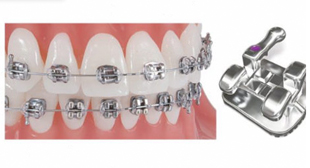 Pinnacle Stainless Steel