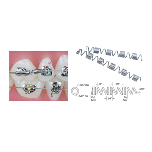TruFlex Nickel Titanium