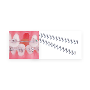 TruFlex Nickel Titanium Open