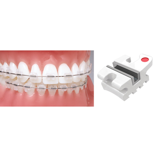 Encore Ceramic Brackets 018