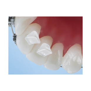 Bite-Builder Ortho Bite