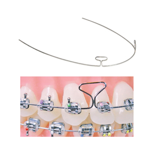 T-Loop Wire .017" x .025" 34mm