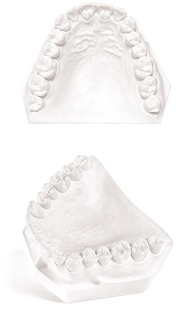 Plaster Fast 25lbs