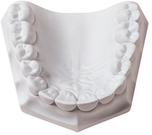 Orthodontic Stone Super White