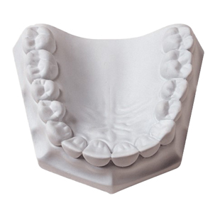 Mounting Plaster Quick-Set