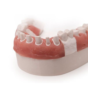 Softissue Moulage Separating