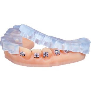KeyPrint KeyOrtho IBT 3D
