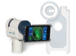 VELscope Vx Enhanced Oral