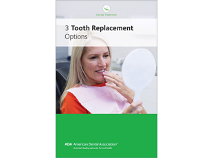 3 Tooth Replacement Options