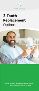 Three Tooth Replacement