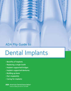 ADA Flip Guide to Dental