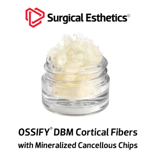 OSSIFY DBM Cortical Fibers