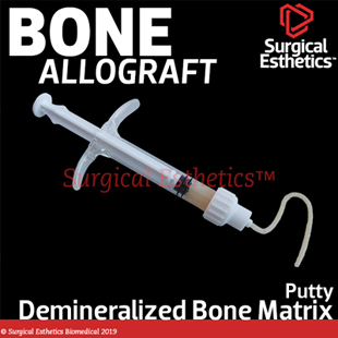 MatrixCellect DBM Allograft