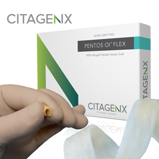 PentOs Ol Flex Demineralized