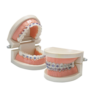 Orthodontic Consultation Two