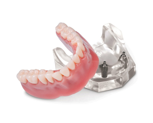 Implant/Prosthetic Patient