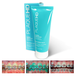 PlaqueHD Toothpaste Mint