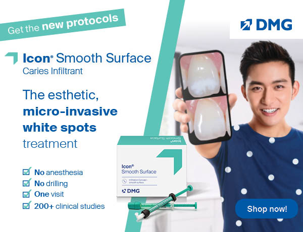dental-Icon-Caries-Infiltration-Proximal-Mini-Kit-dmg-dhp-supplies-deals-discounts