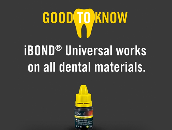 dental-adhesive-kulzer-ibond-dental-supplies