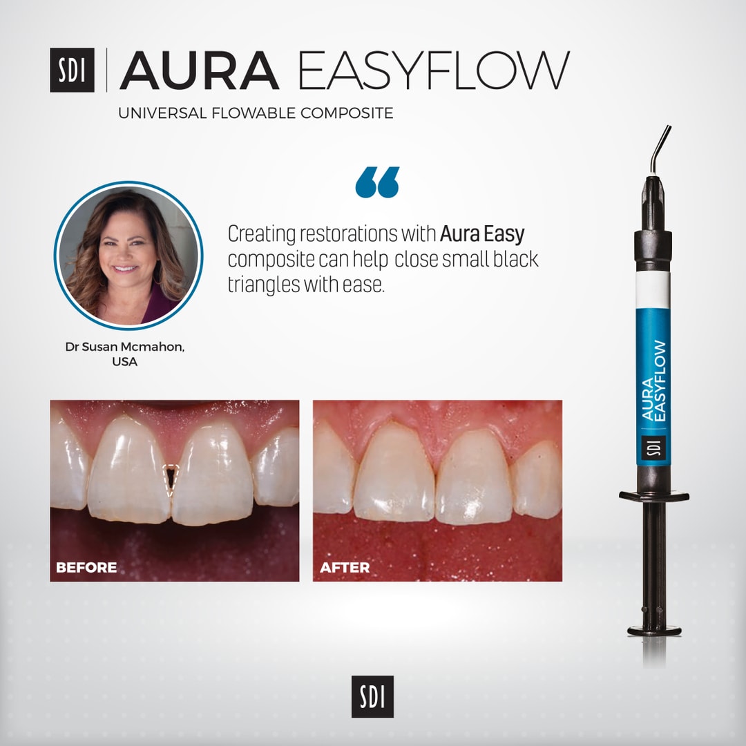 aura-easyflow-universal-flowable-composite